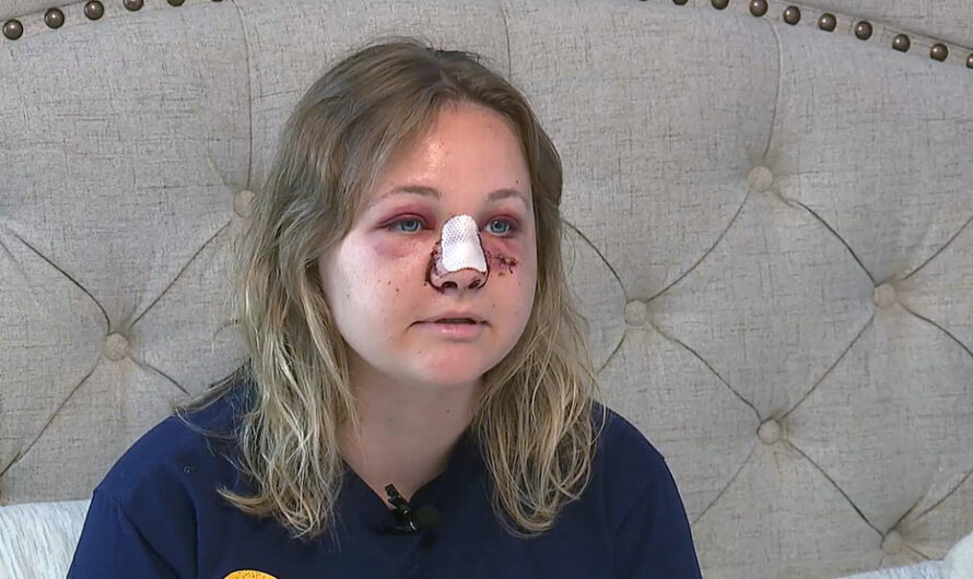 乌克兰女子在美国波特兰中枪毁容，乌克兰的家人都为她担心！